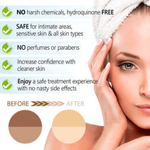Load image into Gallery viewer, skin lightening serum