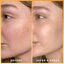 Load image into Gallery viewer, kojic acid skin whitening serum
